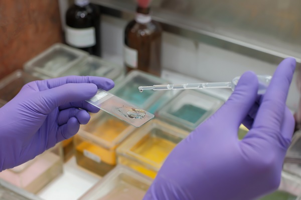 Saúde da mulher: a importância da coleta de preventivo