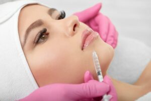 Preenchimento labial: o que você precisa saber antes de realizar o procedimento