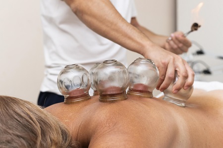 Ventosaterapia e o alívio de dores