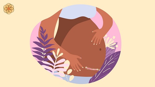 É possível ter parto vaginal após cesariana?