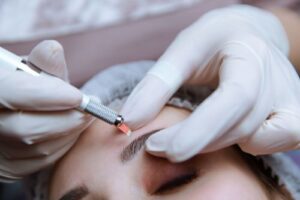 Por que apostar na técnica de micropigmentação de sobrancelhas?